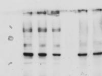 Western blot (public domain)