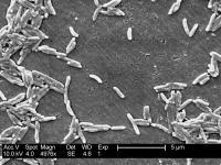 Campylobacter fetu (public domain)