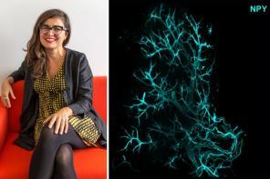 Pictured: Professor Ana Domingos alongside an image of Neuropetide Y in sympathetic axons within a fat pad