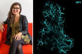 Pictured: Professor Ana Domingos alongside an image of Neuropetide Y in sympathetic axons within a fat pad