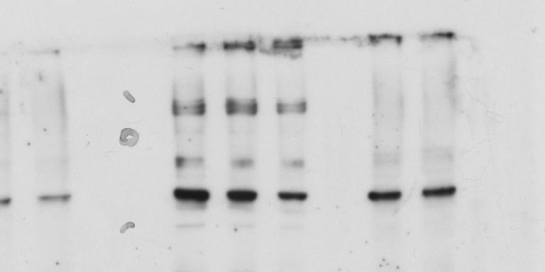 Western blot (public domain)